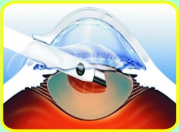 benh vien co thanh toan bhyt khong