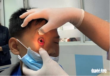 da xac dinh duoc tac nhan gay benh dau mat do o tp hcm