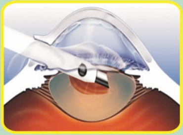 thuc hien cac ky thuat chuyen khoa mat