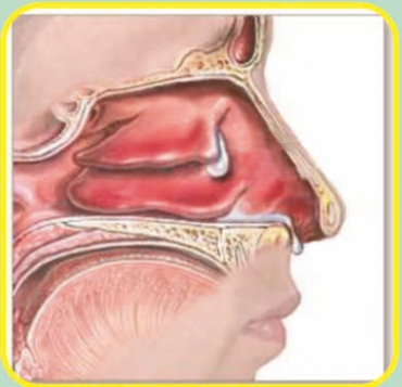 thuc hien cac ky thuat tai mui hong